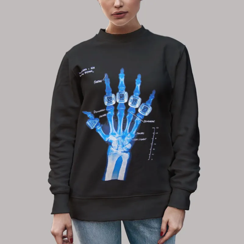 Unisex Sweatshirt Black X Ray Kobe Broken Hand Shirt